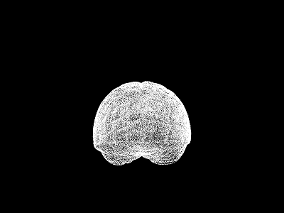 Agrandissement cerveau